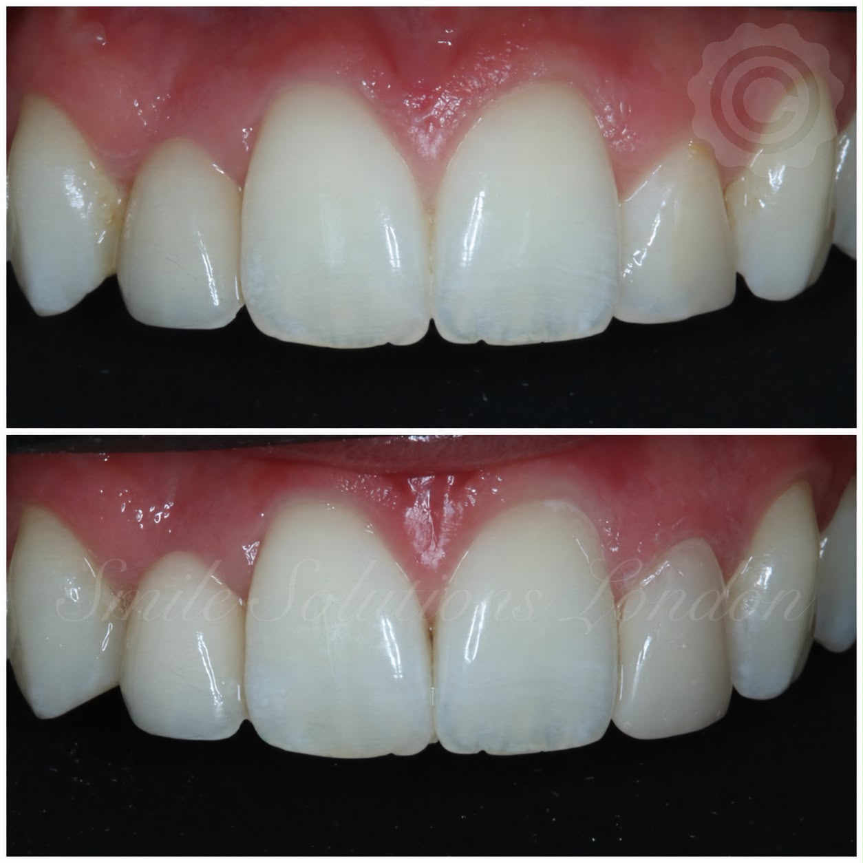 Cosmetic Dentistry & Clinical Skill Why Knowing Your Limits Matters