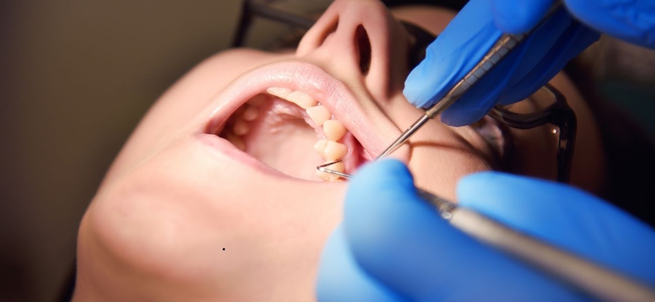 Why Do Dentists Give Different Quotes? Understanding Dental Treatment Plans